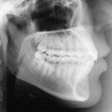 Radiologia Odontológica em Vitória
